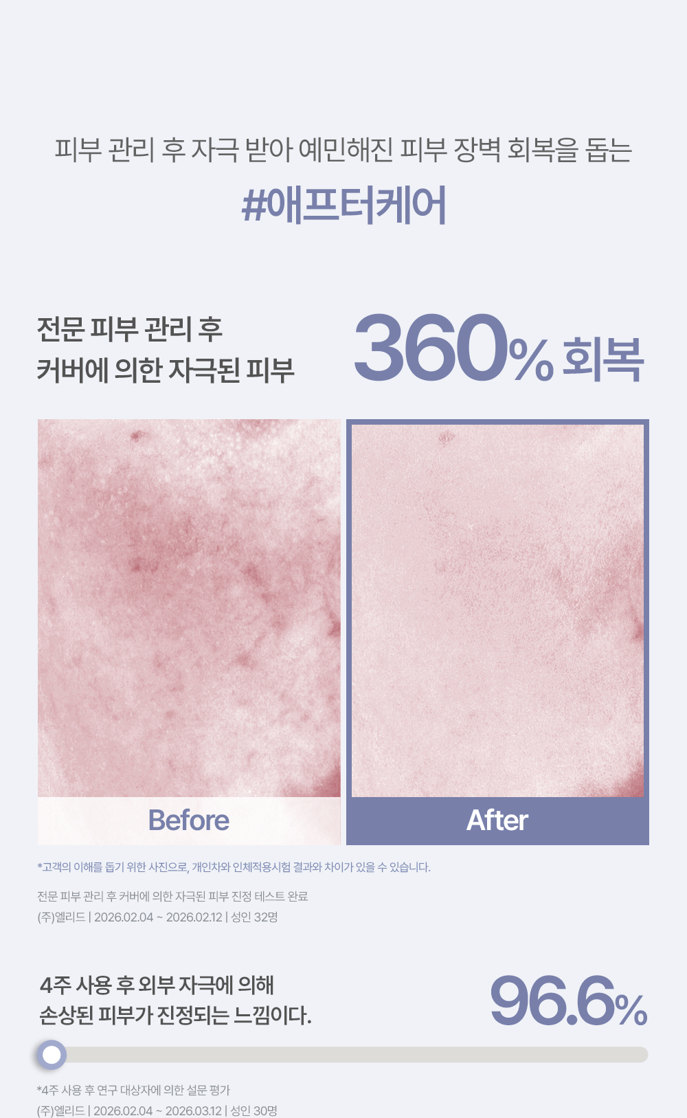Derma Cover Blemish Balm